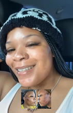 Load image into Gallery viewer, Virtual Skincare Consultation